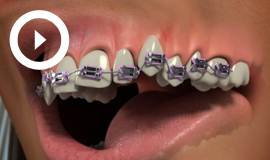 Orthodontics